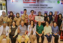 50 Pasien Jalani Operasi Gratis Sumbing Bibir di RSU Hermina Bogor