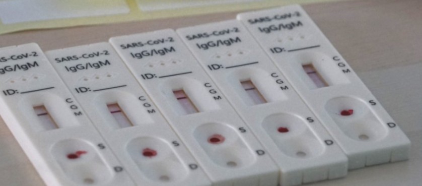 Komisi Pemberantasan Korupsi Gelar Rapid Test Covid-19 di Gedung Merah Putih KPK.