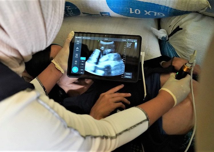 USG Bantu Pemeriksaan Kesehatan Ibu Hamil di Badui