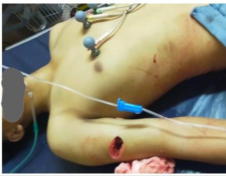 Polsek Tanjungsari Lakukan Olah TKP Terkait Pelajar Tewas dalam Aksi Tawuran