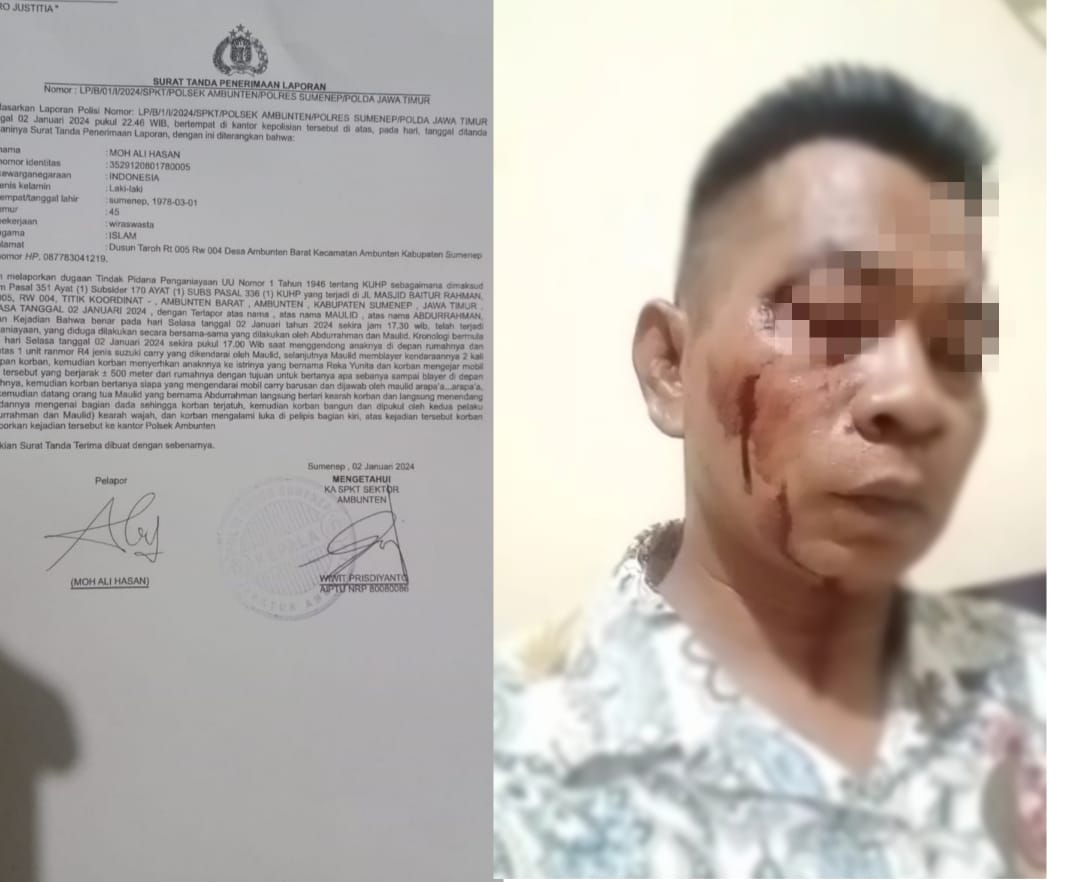 2 Oknum Guru Ngaji Ambunten Barat Lakukan Penganiayaan Brutal Kepada Wartawan