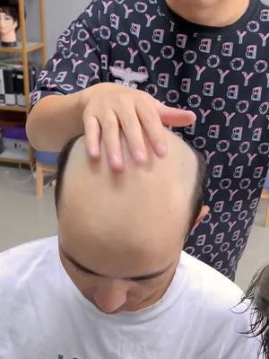#hairtopper #hairloss #thinninghair #hairconfidence #hairtok 