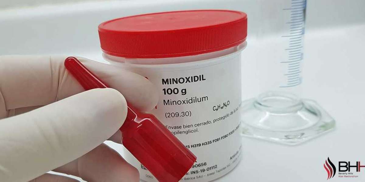 Minoxidil Treatment