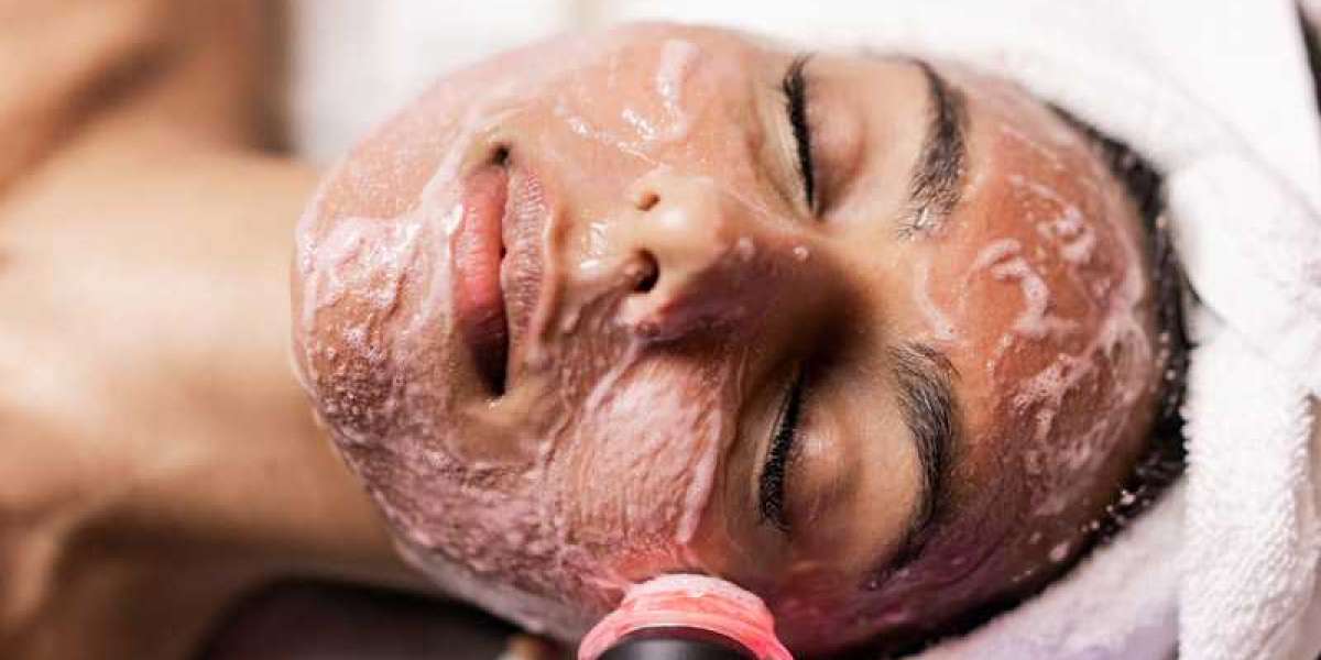Revive Beauty Solutions Offers You Among The Best Microdermabrasion Treatment