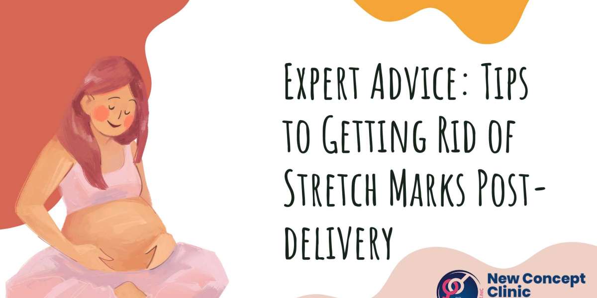 Expert Advice: Tips to Getting Rid of Stretch Marks Post-delivery