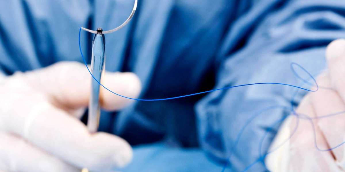 Suture Needles Market Share 2022 Global Business Industry  Revenue, Demand and Applications Market Research Report to 20