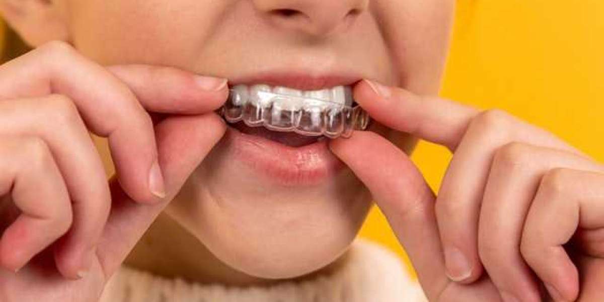 how much does invisalign cost in south africa