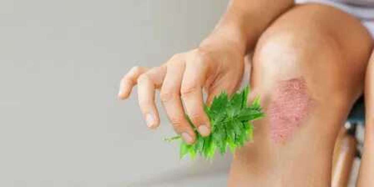 Eczema Therapeutics Market - Opportunities, Share, Growth and Competitive Analysis