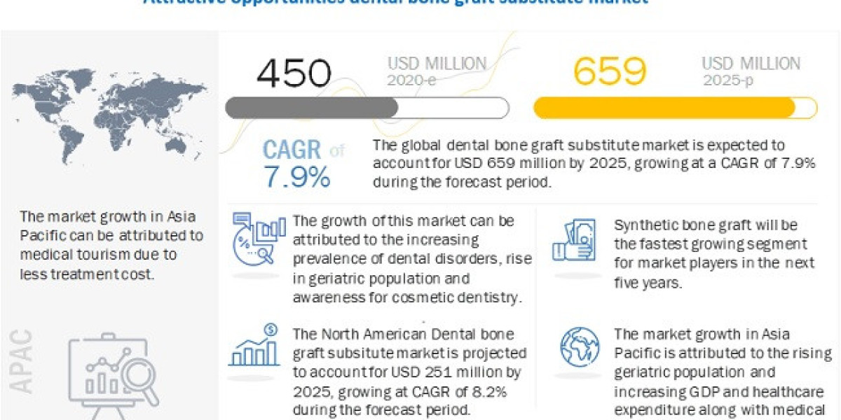 Dental Bone Graft Substitute Market 2020-2025 Analysis, Trends and Forecasts