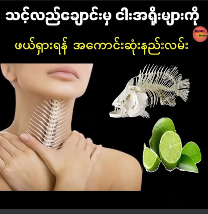 သင့်လည်ချောင်းမှ ငါးရိုးများကို ဖယ်ရှားရန် အကောင်းဆုံးနည်းလမ်း