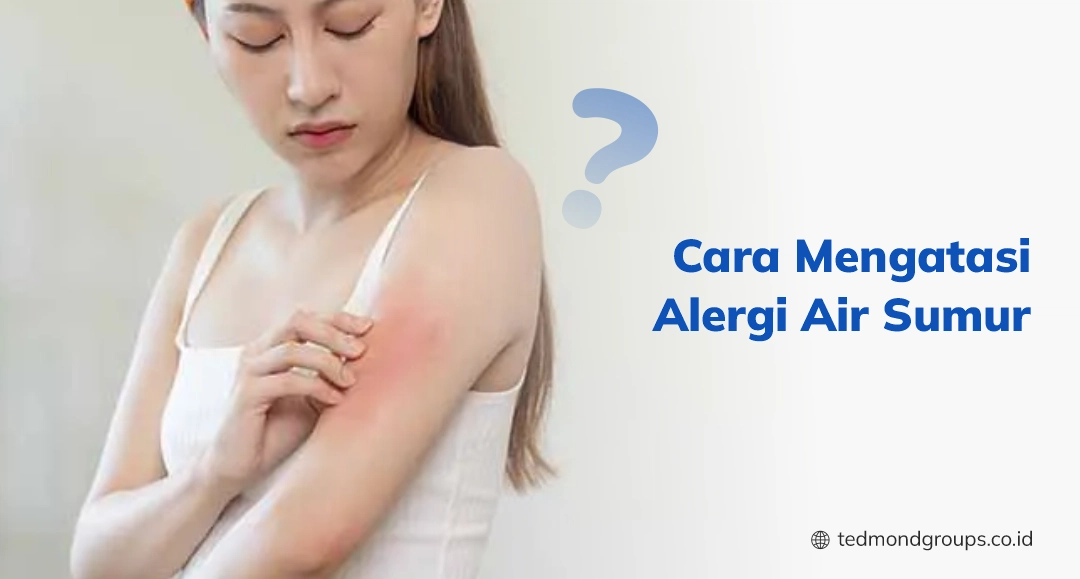 Cara mengatasi alergi air sumur