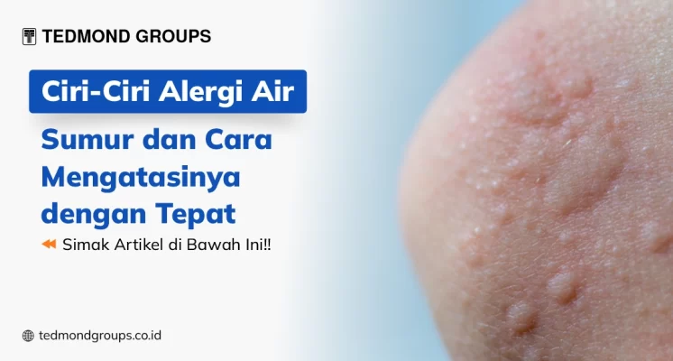 Ciri ciri alergi air sumur dan cara mengatasinya dengan tepat