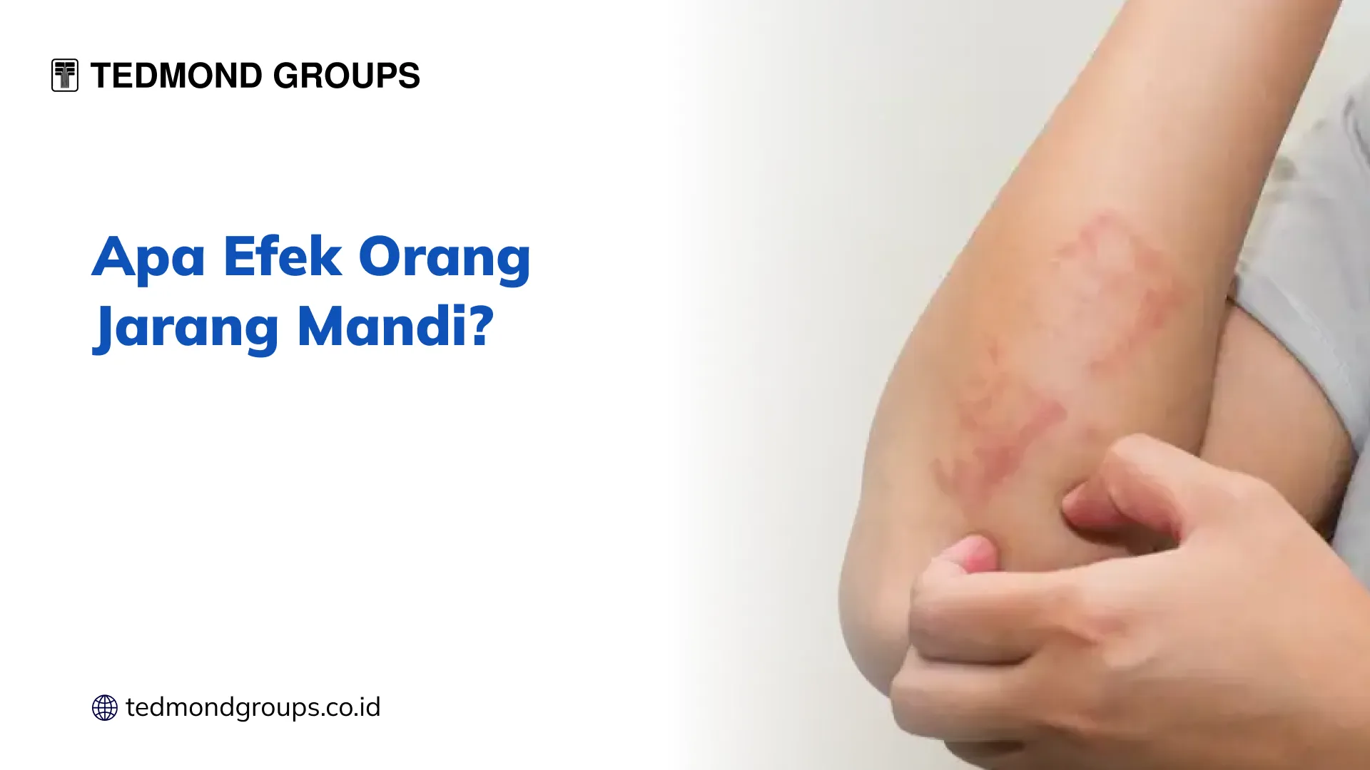 Apa Efek Orang Jarang Mandi?