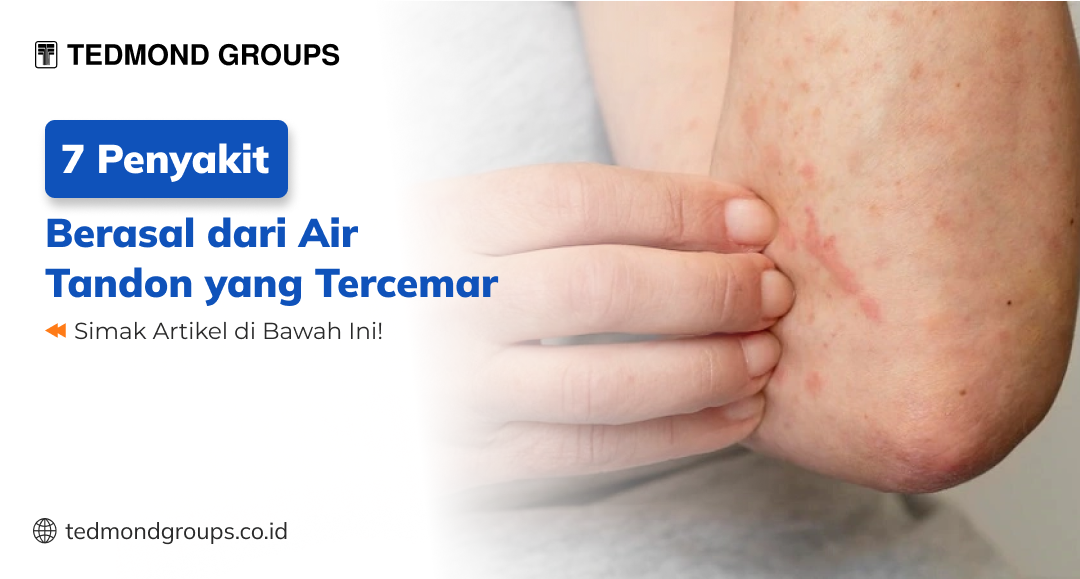 7 penyakit berasal dari air tandon yang tercemar