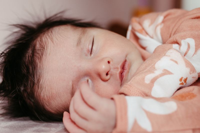 Bayi Kuning: Kapan Normal, Kapan Harus ke Dokter