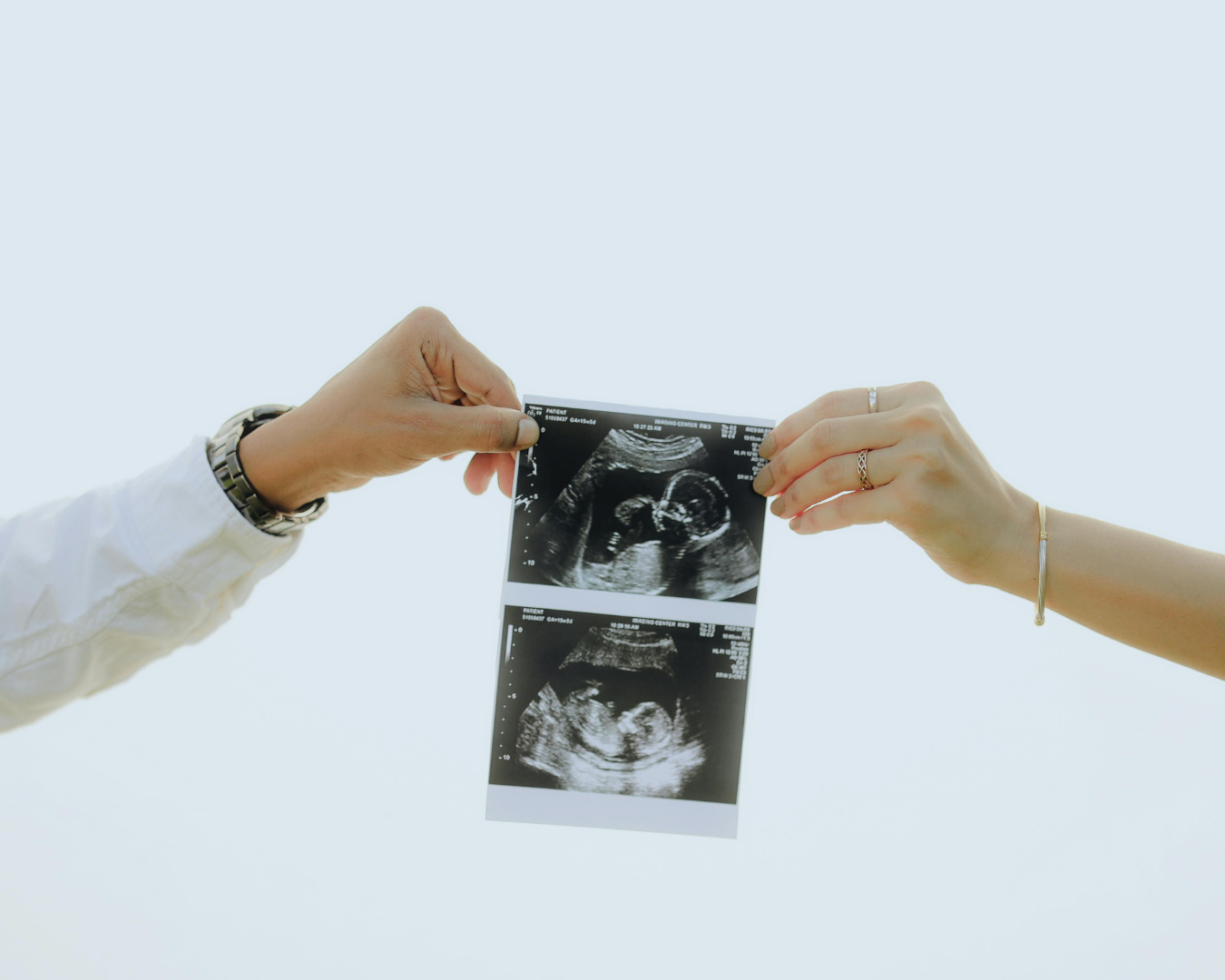 kalau-sudah-masuk-41-weeks-emang-harus-langsung-induksi