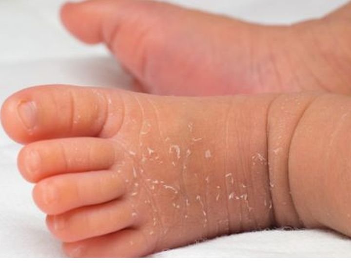 Cara Melembapkan Kulit Bayi