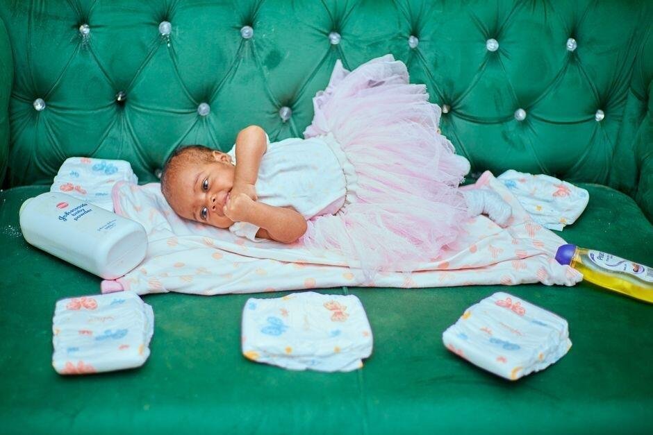Apa Itu Hypoallergenic? Ini Pentingnya untuk Kulit Bayi