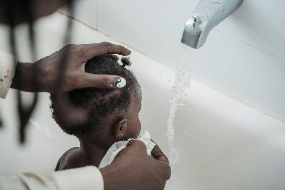 Rambut Pitak pada Bayi, Normal atau Perlu Diwaspadai?