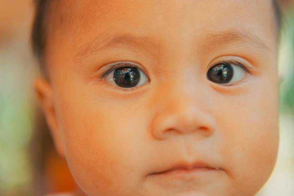 Bintik Kecil di Wajah Bayi tapi Bukan Milia? Ini Kemungkinannya