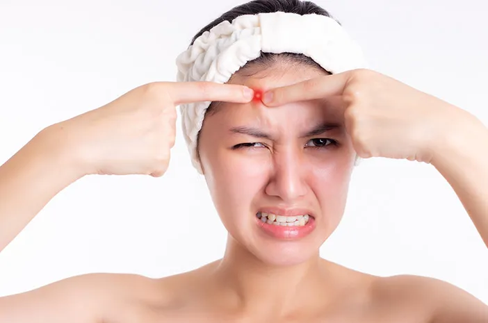 Skincare Routine untuk Kulit Berminyak dan Berjerawat