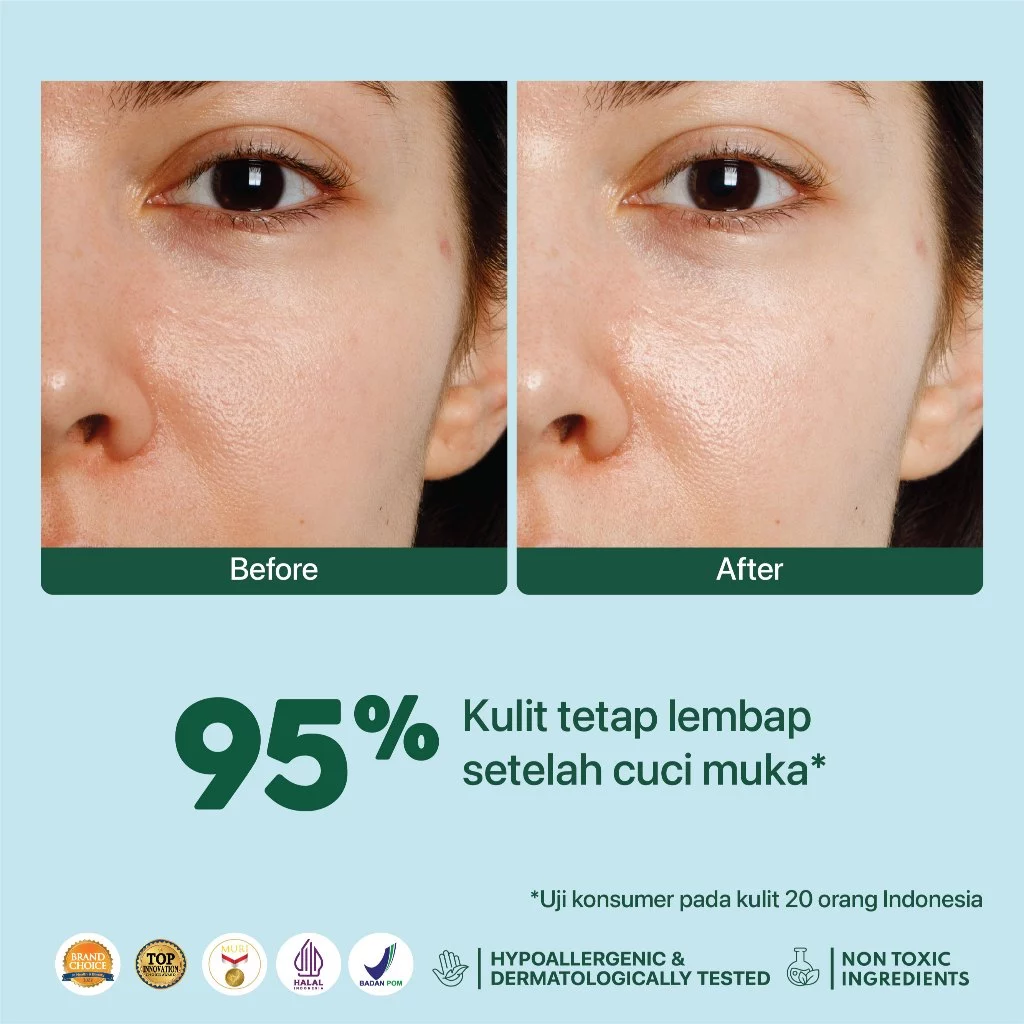 Facial Wash Anti Jerawat Non SLS | NPURE Cica Cleanser 4