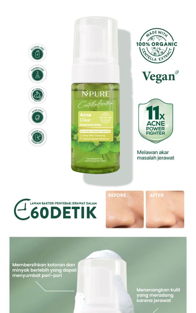 Facial wash Cica NPURE untuk kulit berjerawat