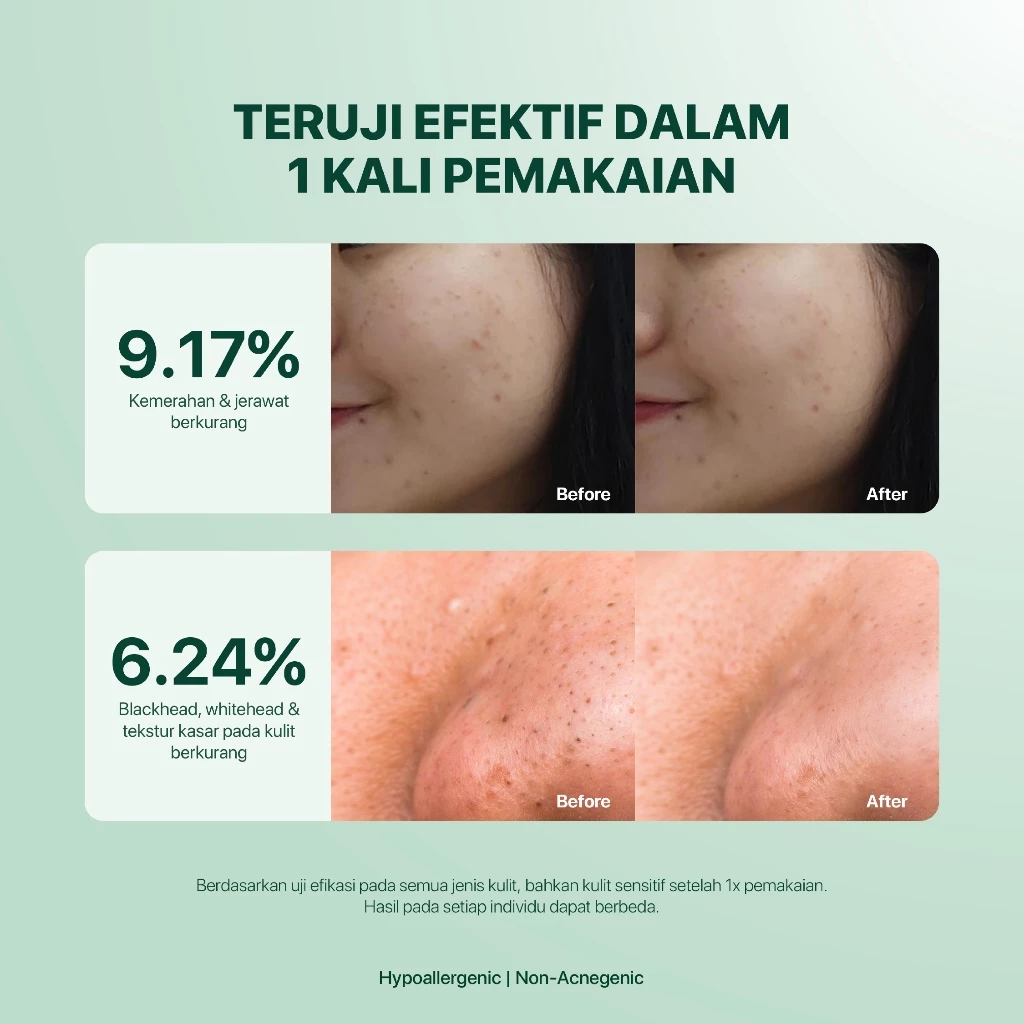 NPURE Gentle Exfoliation Pad Acne Clear Pad Cica 40 Pads 4