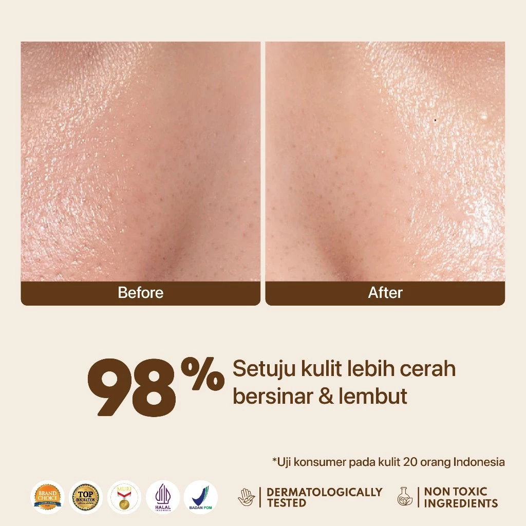 Bundling Skincare Brightening NPURE Licorice Serum Moisturizer 4