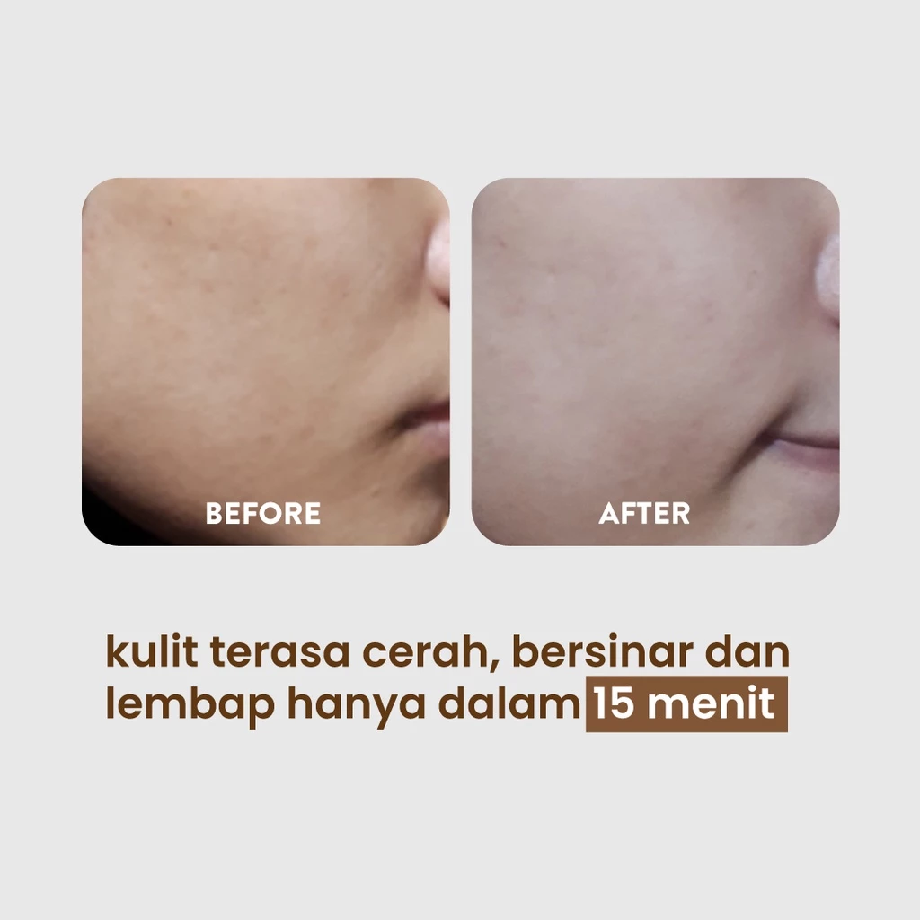 NPURE Licorice Ultra Light Complete Face Essence Sheet Mask 5