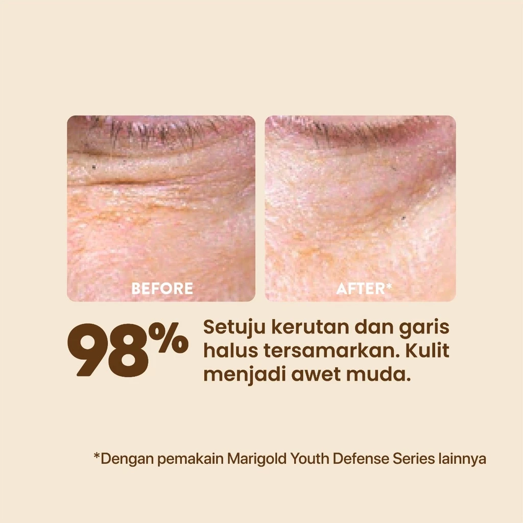 NPURE Marigold Sheet Mask untuk Awet Muda Glowing dan Hydrating 3