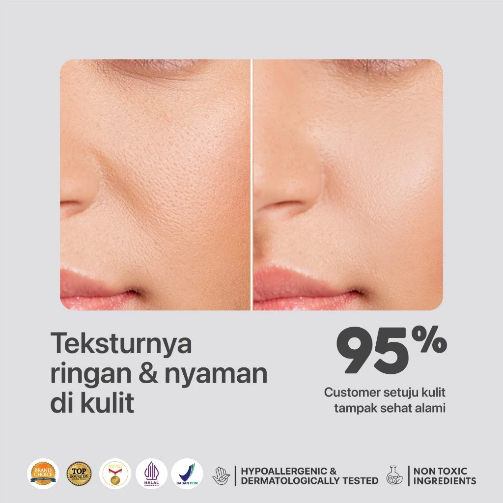 NPURE Noni Moisturizer untuk Kulit Sensitif Eksim Ceramide 4
