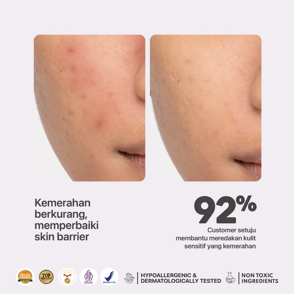 NPURE NONI Probiotics Hypoallergenic Calm Me Down Sensitive Face Serum 4