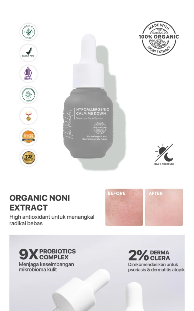 Serum probiotik untuk memperbaiki skin barrier rusak