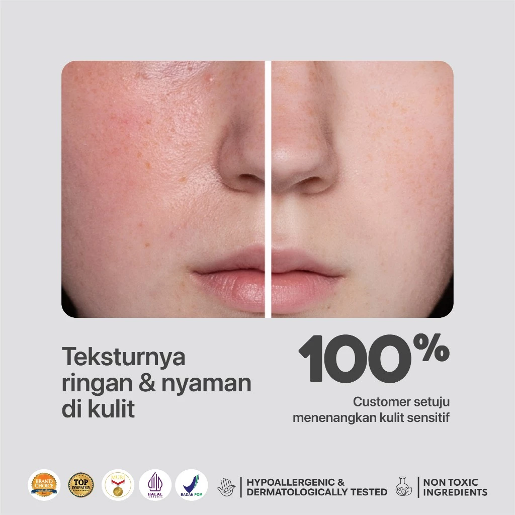 NPURE Noni Toner untuk Kulit Sensitif Kemerahan Ceramide 3