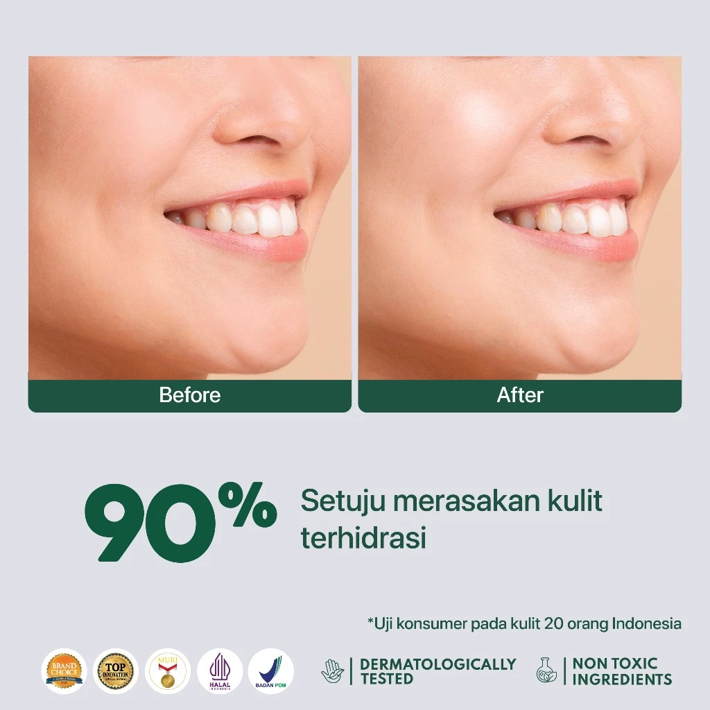 Sheet Mask Anti Jerawat dengan Centella | NPURE Cica Acne Care 4