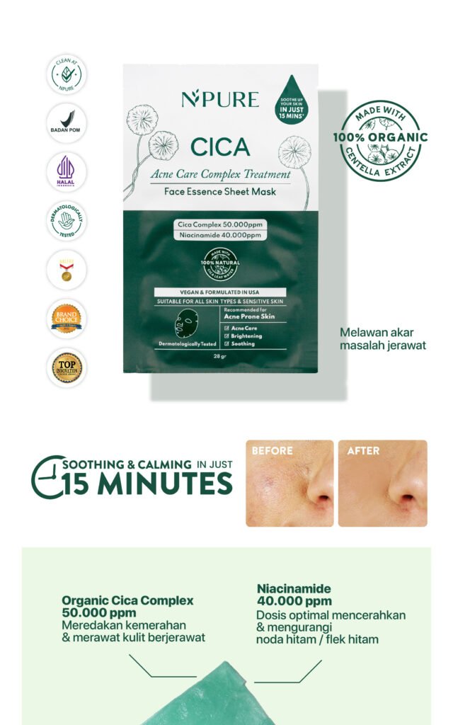 Masker wajah Centella untuk kulit berjerawat