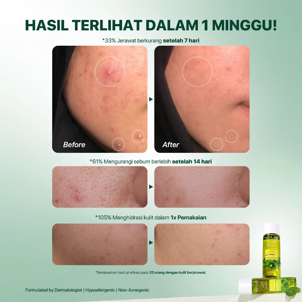 Acne Toner Ukuran Besar NPURE Cica Hydrating Centella 6