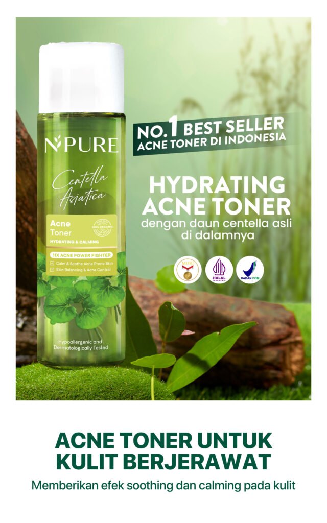 Toner kulit berjerawat NPURE Cica